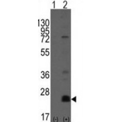 CD9 Antigen (CD9) Antibody